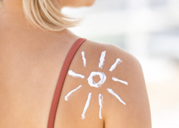 Sunčanje, uz oprez, može da ima pozitivan efekat na psorijazu